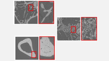 SR-µCT tomograms