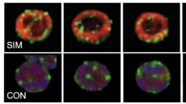 Protease FtsH4