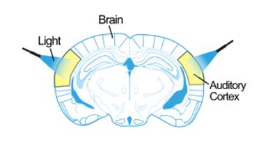 Optogenetics