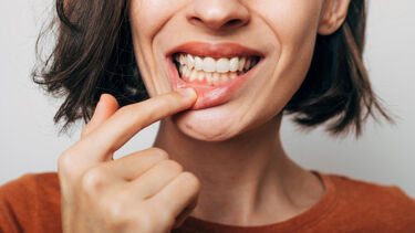 A woman pulling her bottom lip down showing her teeth and gums. Wearing an orange jumper.